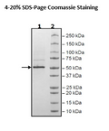 Nucleocapsid Protein (B.1.1.7, Alpha Variant), Avi-His-Tag (SARS-CoV-2) Recombinant – Figure 1 of 1