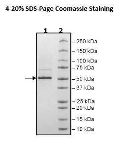 Nucleocapsid Protein (B.1.1.7, Alpha Variant), Avi-His-Tag (SARS-CoV-2) Recombinant – Figure 1 of 1
