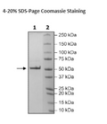 Nucleocapsid Protein (P.1, Gamma Variant), Avi-His-Tag (SARS-CoV-2) Recombinant – Figure 1 of 1