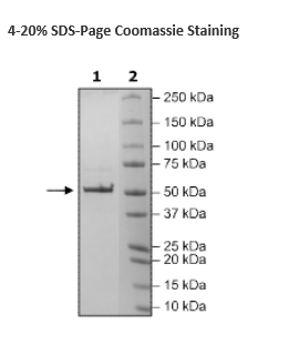 Nucleocapsid Protein (P.1, Gamma Variant), Avi-His-Tag (SARS-CoV-2) Recombinant – Figure 1 of 1