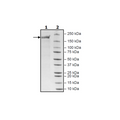 Spike Trimer (S1+S2) (K417T, E484K, N501Y), His-Tag (SARS-CoV-2) Recombinant – Figure 1 of 1