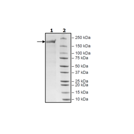 Spike Trimer (S1+S2) (K417T, E484K, N501Y), His-Tag (SARS-CoV-2) Recombinant – Figure 1 of 1