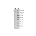 Spike Trimer (S1+S2) (P.1 Variant), His-Tag (SARS-CoV-2) Recombinant – Figure 1 of 1
