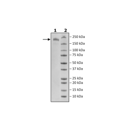 Spike Trimer (S1+S2) (P.1 Variant), His-Tag (SARS-CoV-2) Recombinant – Figure 1 of 1