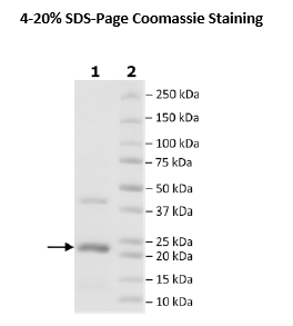CLPP, His-Tag (E. coli) Recombinant – Figure 1 of 1