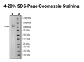 Spike S1 (B.1.351, Beta Variant), Avi-His-Tag (SARS-CoV-2) Recombinant – Figure 1 of 1