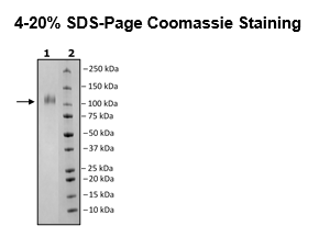 Spike S1 (B.1.351, Beta Variant), Avi-His-Tag (SARS-CoV-2) Recombinant – Figure 1 of 1