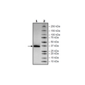 Spike S1 RBD (K417T, E484K, N501Y), Avi-His-Tag (SARS-CoV-2) Recombinant – Figure 1 of 1