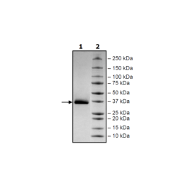 Spike S1 RBD (K417T, E484K, N501Y), Avi-His-Tag (SARS-CoV-2) Recombinant – Figure 1 of 1