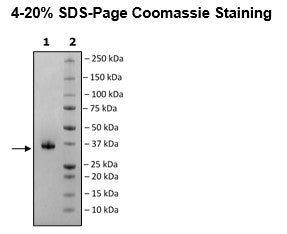 Spike S1 RBD (B.1.1.7; Alpha Variant), Avi-His-Tag, Biotin-Labeled (SARS-CoV-2) HiP™ Recombinant – Figure 1 of 3