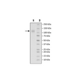 Spike S1 (B.1.1.7, Alpha Variant), Avi-His-Tag (SARS-CoV-2) – Figure 1 of 1