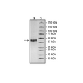 CD5L, Avi-His-Tag Recombinant – Figure 1 of 1