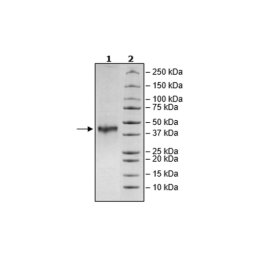 CD5L, Avi-His-Tag Recombinant – Figure 1 of 1