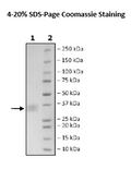 CLEC1A, His-Tag Recombinant – Figure 1 of 1