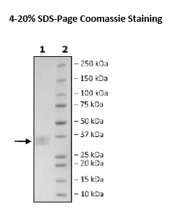 CLEC1A, His-Tag Recombinant – Figure 1 of 1