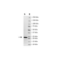 MSP1D1, His-Tag Recombinant – Figure 1 of 1