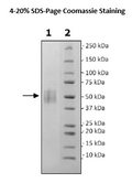 CD19, Avi-His-Tag Recombinant – Figure 1 of 1