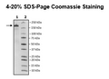 Spike Trimer (S1+S2) (B.1.429, Epsilon Variant) His-Tag (SARS-CoV-2) Recombinant – Figure 1 of 1