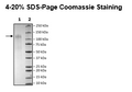 Spike S1 (P.1, Gamma Variant), Avi-His-Tag (SARS-CoV-2) Recombinant – Figure 1 of 1