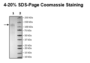 Spike S1 (P.1, Gamma Variant), Avi-His-Tag (SARS-CoV-2) Recombinant – Figure 1 of 1