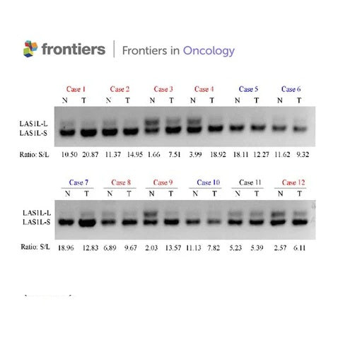 2× Hieff™ HotStart PCR Genotyping Master Mix (With Dye)