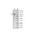 Spike S1 (P.1 Variant), Avi-His-Tag, Biotin-Labeled (SARS-CoV-2) Recombinant – Figure 1 of 2