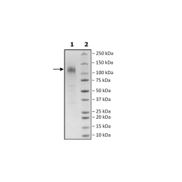 Spike S1 (P.1 Variant), Avi-His-Tag, Biotin-Labeled (SARS-CoV-2) Recombinant – Figure 1 of 2