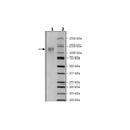 Spike S1 (K417T, E484K, N501Y), Avi-His-Tag (SARS-CoV-2) Recombinant – Figure 1 of 1
