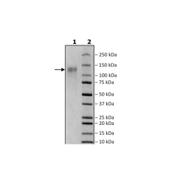 Spike S1 (K417T, E484K, N501Y), Avi-His-Tag (SARS-CoV-2) Recombinant – Figure 1 of 1