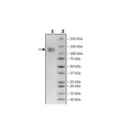 Spike S1 (K417T, E484K, N501Y), Avi-His-Tag, Biotin-Labeled (SARS-CoV-2) Recombinant – Figure 1 of 2