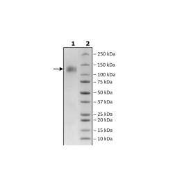 Spike S1 (K417T, E484K, N501Y), Avi-His-Tag, Biotin-Labeled (SARS-CoV-2) Recombinant – Figure 1 of 2