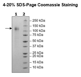 Spike S1 (B.1.618 Variant), Avi-His-Tag (SARS-CoV-2) Recombinant – Figure 1 of 1