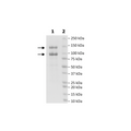 CDK13/Cyclin K, GST-Tags Recombinant – Figure 1 of 1