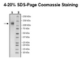 Spike S1 (B.1.429 Variant), Avi-His-Tag (SARS-CoV-2) Recombinant – Figure 1 of 1