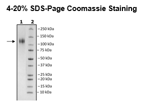 Spike S1 (B.1.429 Variant), Avi-His-Tag (SARS-CoV-2) Recombinant – Figure 1 of 1