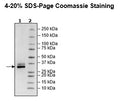 ELANE (Elastase), Avi-His-Tag HiP™ Recombinant – Figure 1 of 2