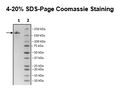 Spike Trimer (S1+S2) (B.1.617 Variant), His-Tag (SARS-CoV-2) Recombinant – Figure 1 of 1