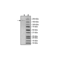 Spike Trimer (S1+S2) (B.1.617.1, Kappa Variant), His-Tag (SARS-CoV-2) Recombinant – Figure 1 of 1