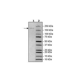 Spike Trimer (S1+S2) (B.1.617.1, Kappa Variant), His-Tag (SARS-CoV-2) Recombinant – Figure 1 of 1