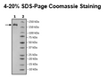 Spike Trimer (S1+S2) (B.1.618 Variant), His-Tag (SARS-CoV-2) Recombinant – Figure 1 of 1