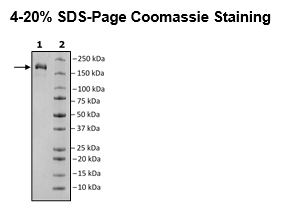 Spike Trimer (S1+S2) (B.1.618 Variant), His-Tag (SARS-CoV-2) Recombinant – Figure 1 of 1