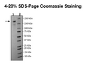 Spike Trimer (S1+S2) (B.1.617.2; Delta Variant), His-Tag (SARS-CoV-2) Recombinant – Figure 1 of 1