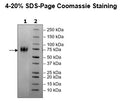 IL-2RG, Avi-His-Tag Recombinant – Figure 1 of 1