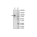 IL-2RG, Avi-His-Tag, Biotin-Labeled Recombinant – Figure 1 of 2