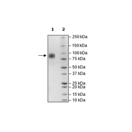IL-2RG, Avi-His-Tag, Biotin-Labeled Recombinant – Figure 1 of 2