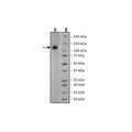 Spike S1 (B.1.617.2, Delta Variant) Avi-His-Tag (SARS-CoV-2) Recombinant – Figure 1 of 1