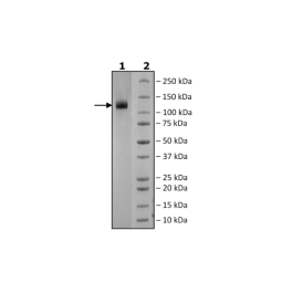 Spike S1 (B.1.617.2, Delta Variant) Avi-His-Tag (SARS-CoV-2) Recombinant – Figure 1 of 1
