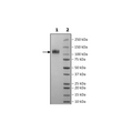 Spike S1 (B.1.617.2, Delta Variant) Avi-His-Tag, Biotin-Labeled (SARS-CoV-2) Recombinant – Figure 1 of 2