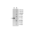 Spike S1 RBD (B.1.617.2, Delta Variant), Avi-His-Tag (SARS-CoV-2) HiP™ Recombinant – Figure 1 of 2