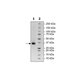 Spike S1 RBD (B.1.617.2, Delta Variant), Avi-His-Tag (SARS-CoV-2) HiP™ Recombinant – Figure 1 of 2